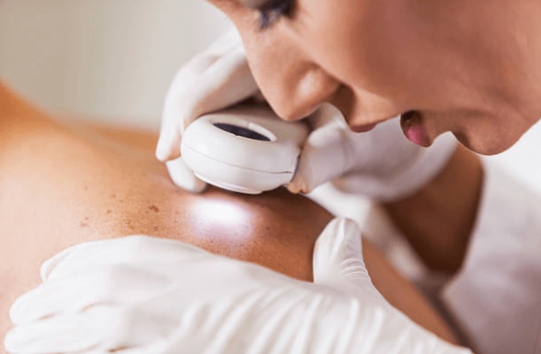 dermatologist inspecting skin up close